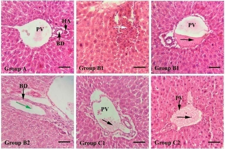 The possible histo-toxicological impacts of long-term dietary supplementation of Soybean and Canola oil on liver in Swiss albino mice