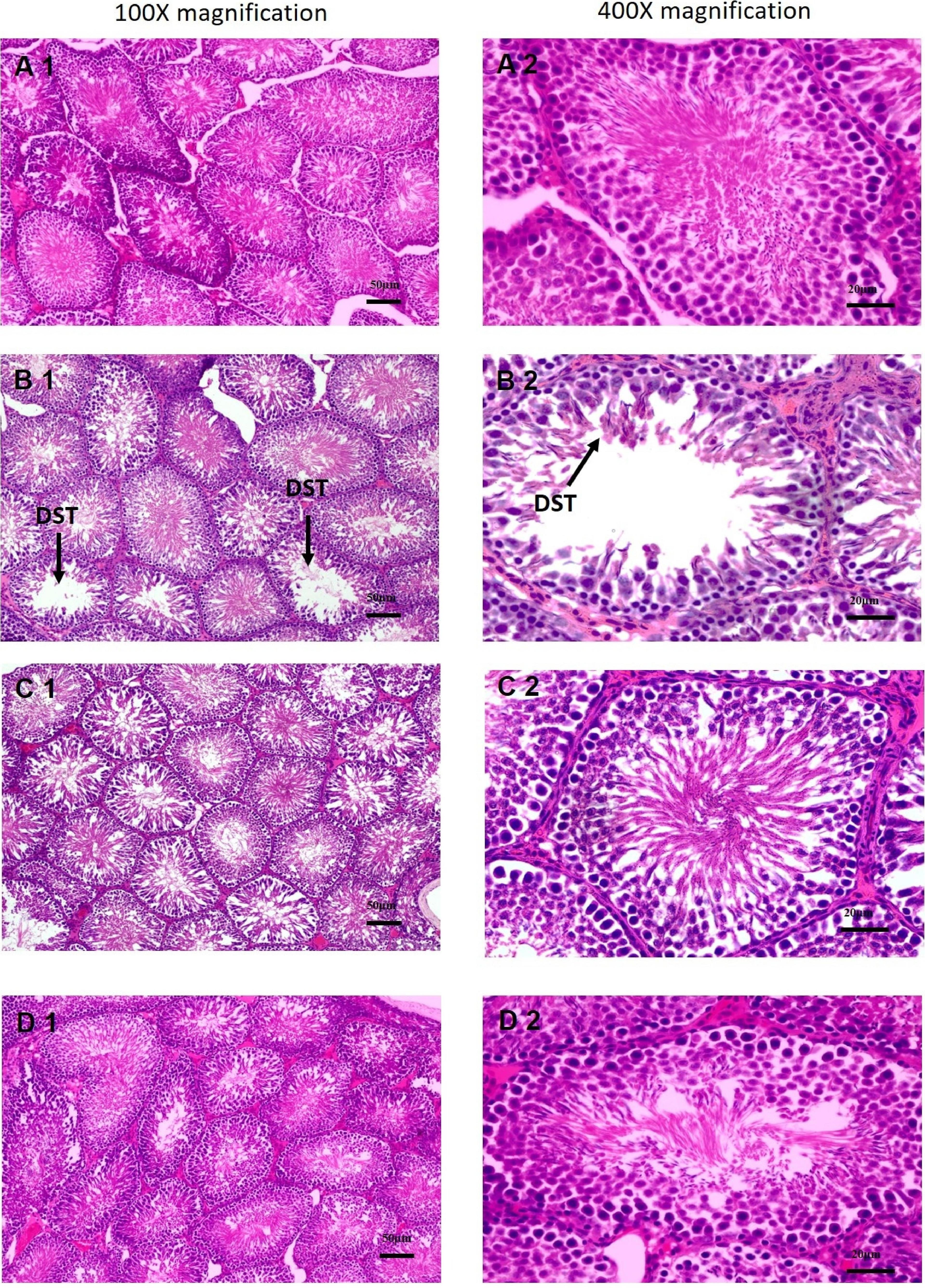 Gonadal health benefits of black cumin (<span>Nigella sativa</span>) seed oil on chronic lead-exposed male Wistar rats