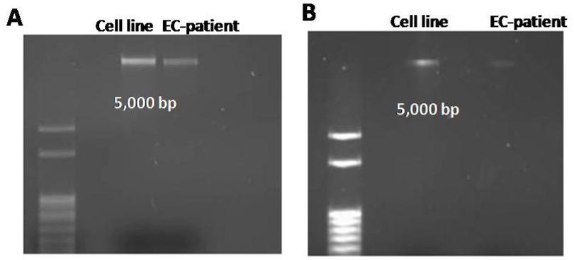 Analysis of telomere length in the coronary artery to determine the pathogenesis of coronary artery disease