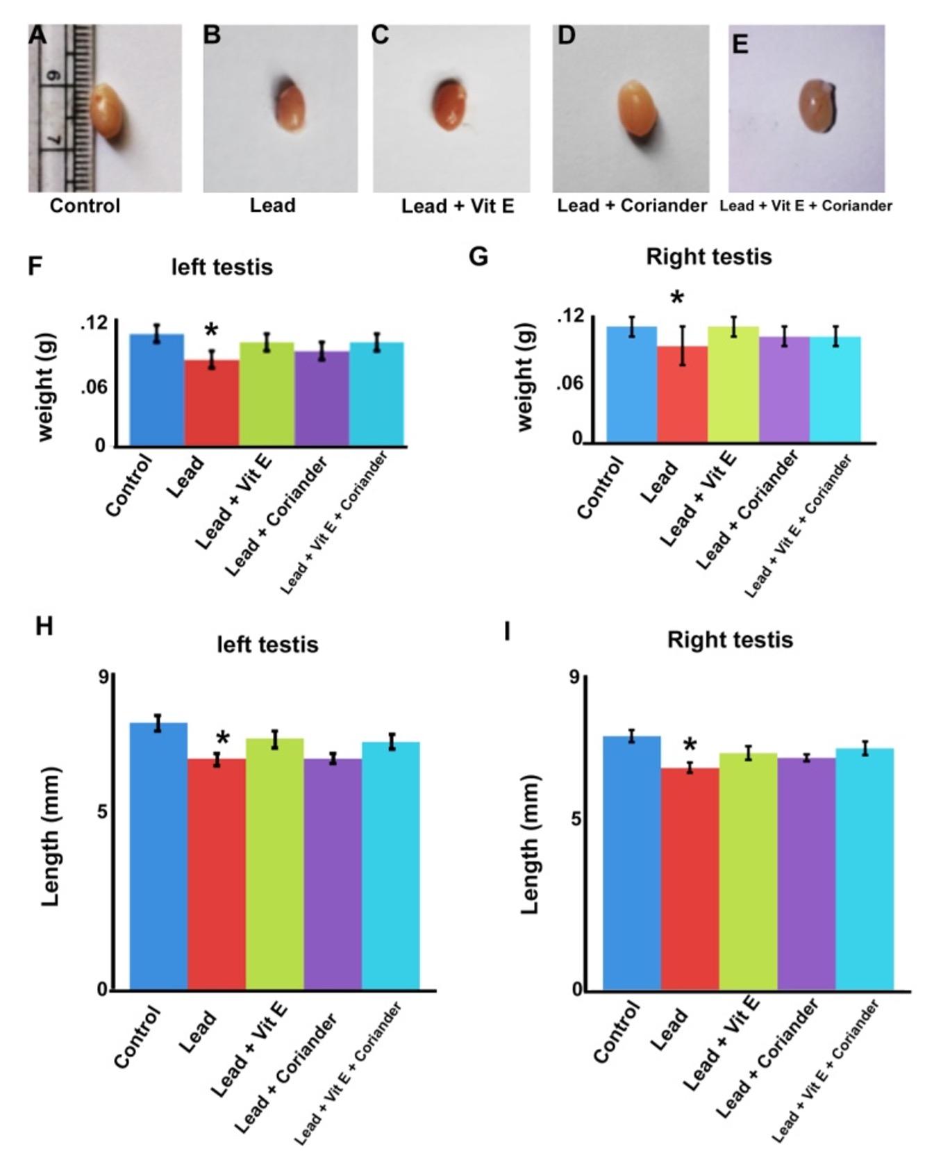 Prophylactic effects of vitamin E and coriander (Coriandrum sativum) extract on lead-induced testicular damage in Swiss albino mice