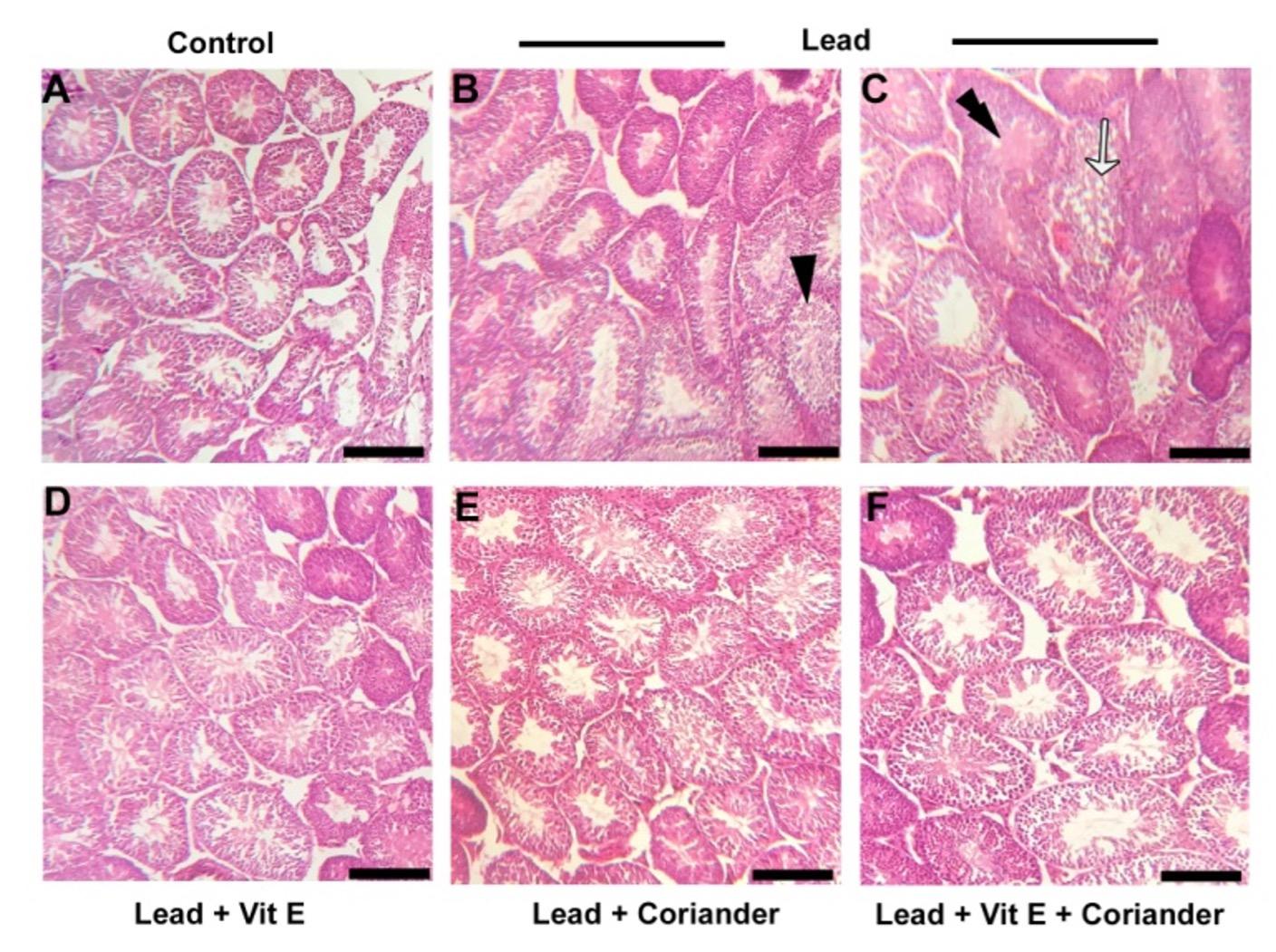 Prophylactic effects of vitamin E and coriander (Coriandrum sativum) extract on lead-induced testicular damage in Swiss albino mice