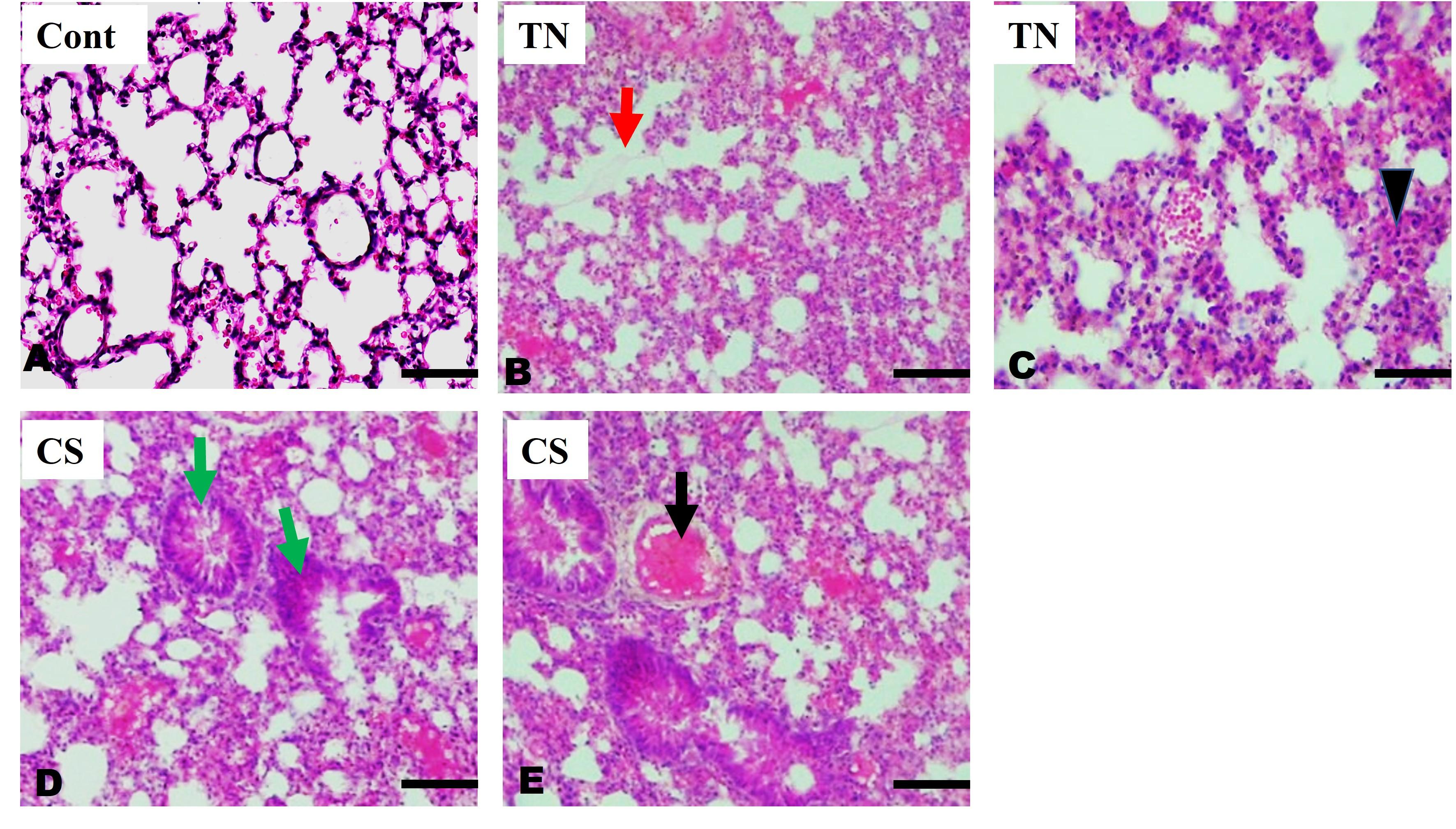 Exposure to tobacco (<span>Nicotiana tabacum</span>) extract and cigarette smoke induces hematological and histopathological alterations in Swiss albino mice