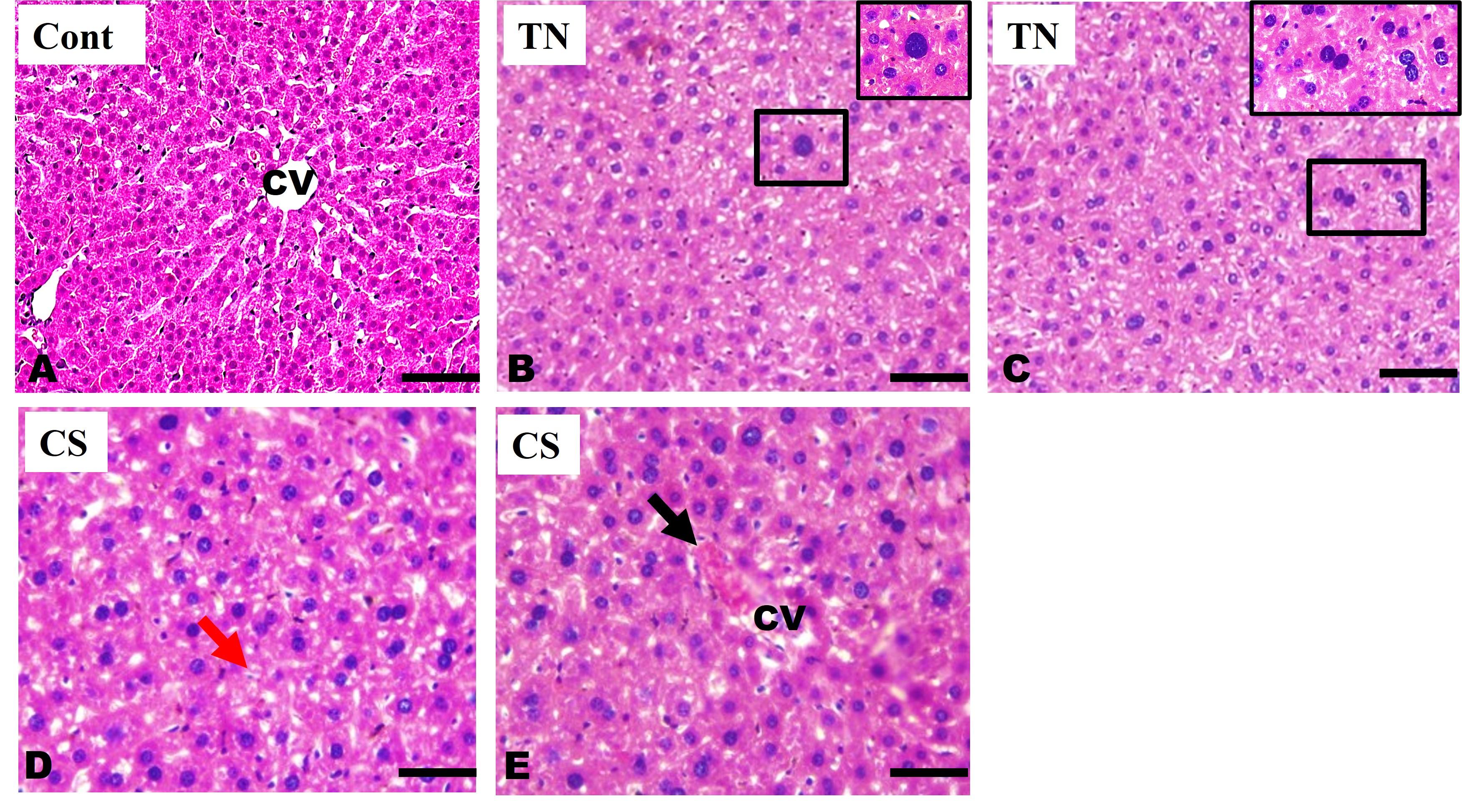 Exposure to tobacco (<span>Nicotiana tabacum</span>) extract and cigarette smoke induces hematological and histopathological alterations in Swiss albino mice