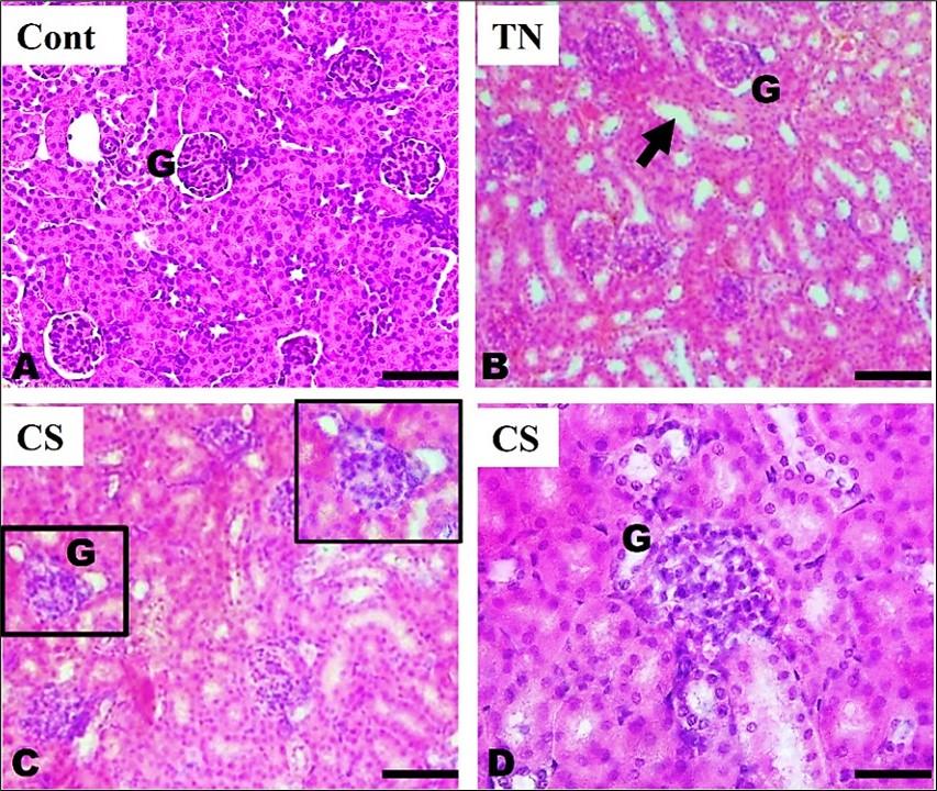 Exposure to tobacco (<span>Nicotiana tabacum</span>) extract and cigarette smoke induces hematological and histopathological alterations in Swiss albino mice