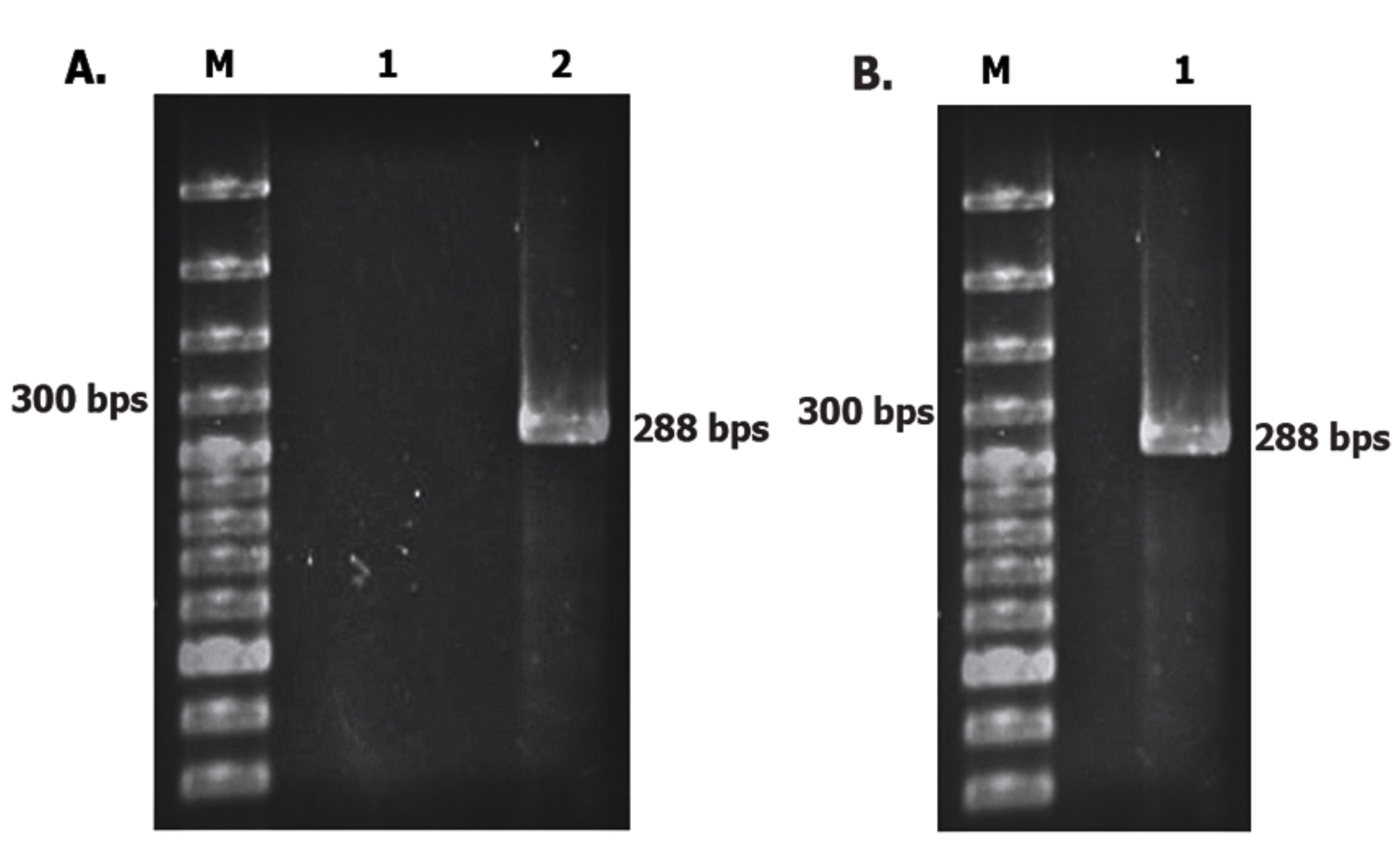 Cloning, expression, and purification of fusion antigens MPT83 and ESAT6 from the local strain of <span>Mycobacterium tuberculosis</span> in <span>Escherichia coli</span> as a seed vaccine candidate against tuberculosis