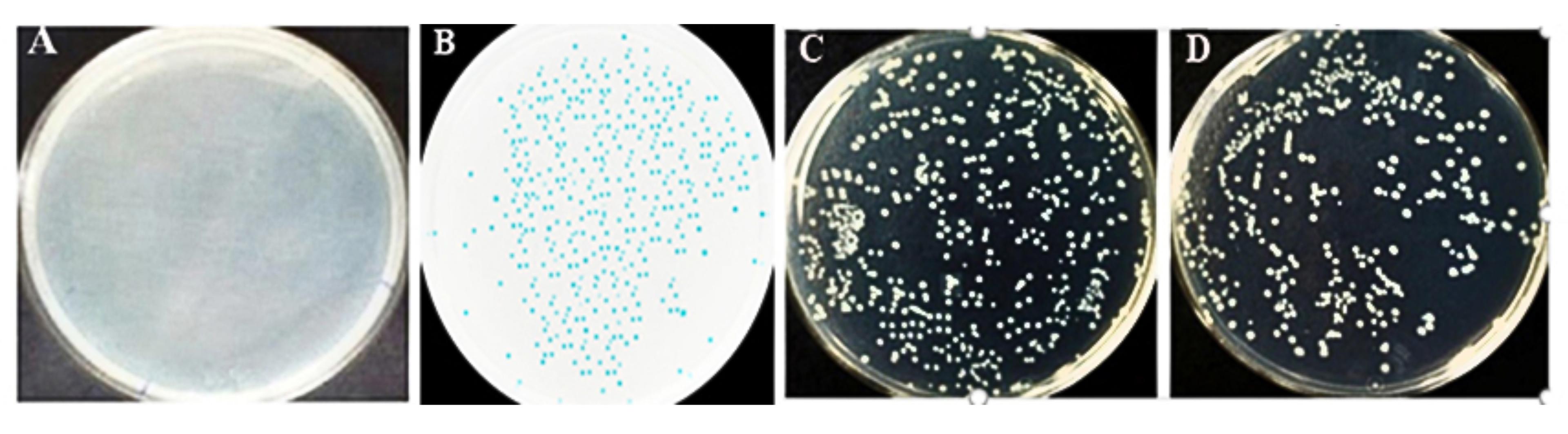 Cloning, expression, and purification of fusion antigens MPT83 and ESAT6 from the local strain of <span>Mycobacterium tuberculosis</span> in <span>Escherichia coli</span> as a seed vaccine candidate against tuberculosis