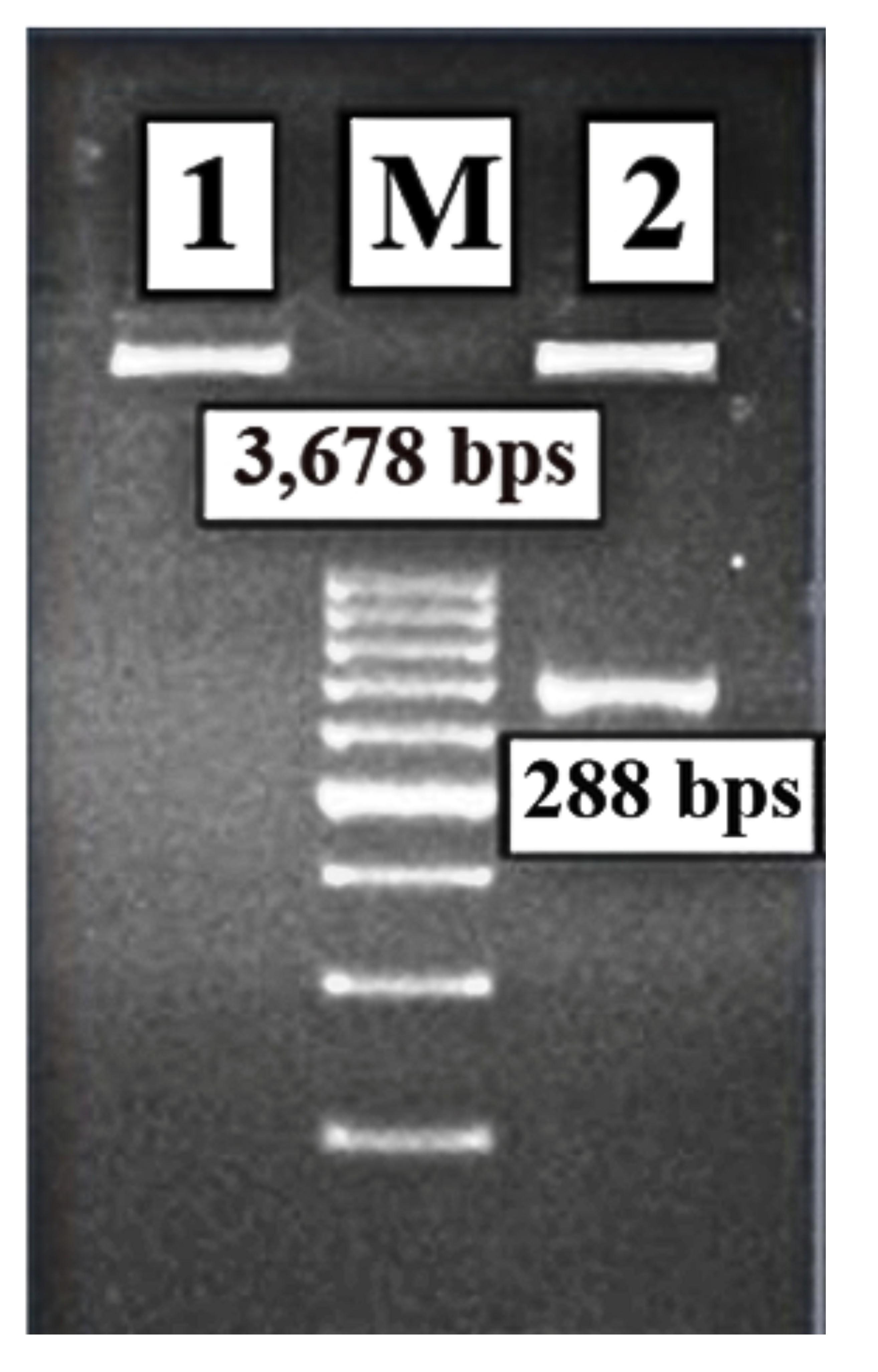 Cloning, expression, and purification of fusion antigens MPT83 and ESAT6 from the local strain of <span>Mycobacterium tuberculosis</span> in <span>Escherichia coli</span> as a seed vaccine candidate against tuberculosis