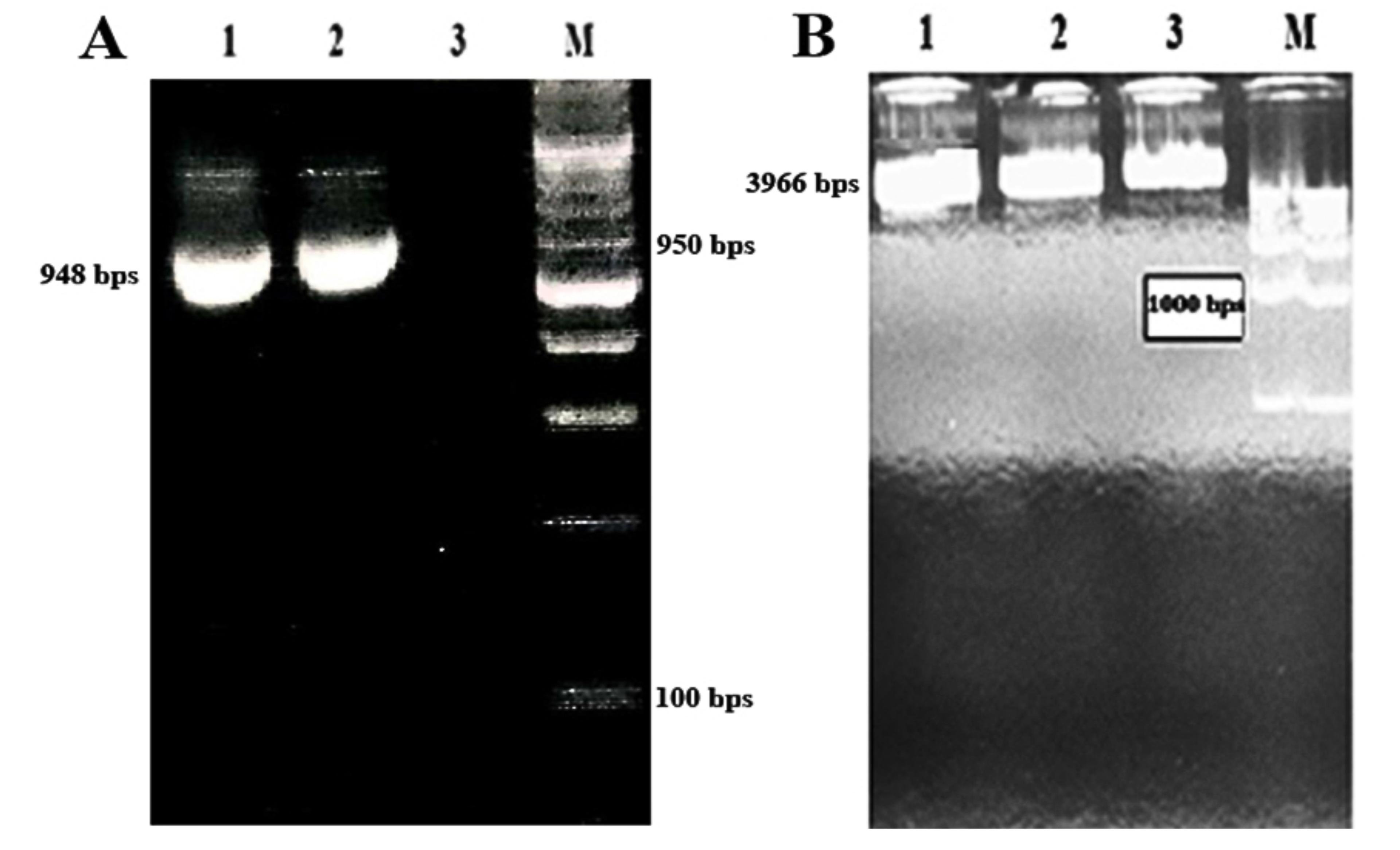 Cloning, expression, and purification of fusion antigens MPT83 and ESAT6 from the local strain of <span>Mycobacterium tuberculosis</span> in <span>Escherichia coli</span> as a seed vaccine candidate against tuberculosis