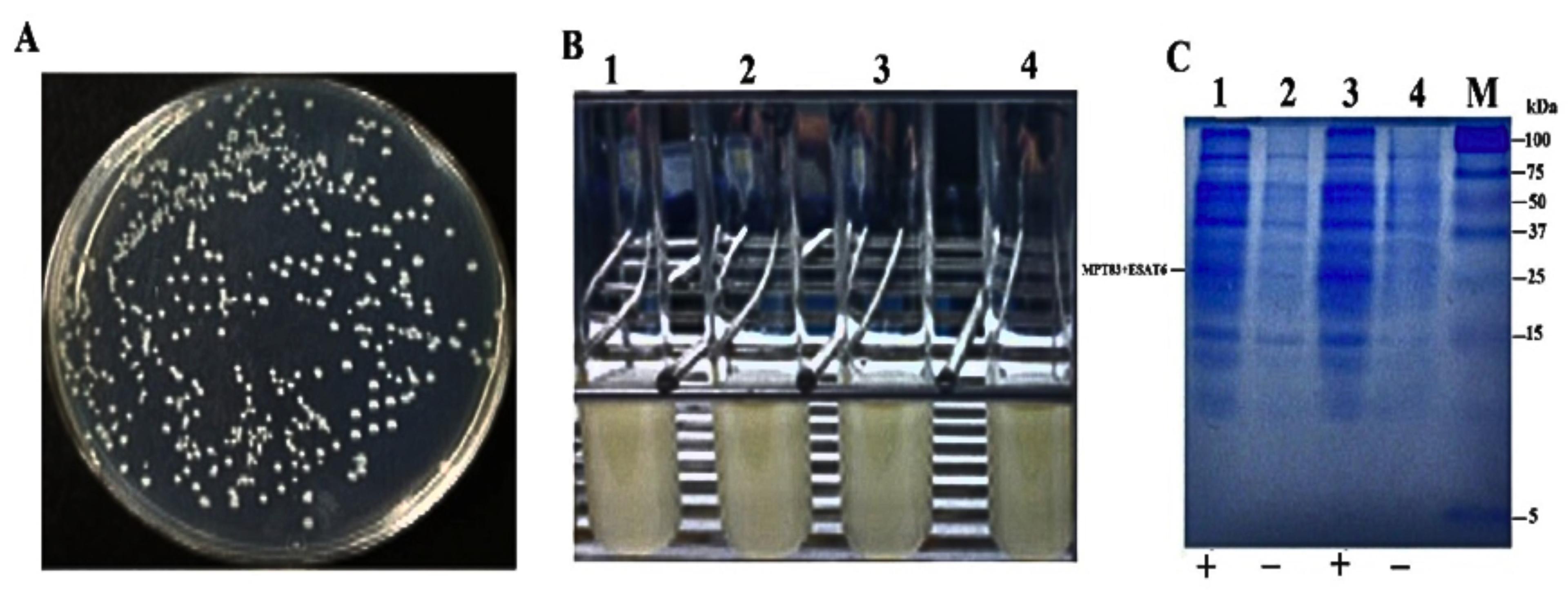 Cloning, expression, and purification of fusion antigens MPT83 and ESAT6 from the local strain of <span>Mycobacterium tuberculosis</span> in <span>Escherichia coli</span> as a seed vaccine candidate against tuberculosis