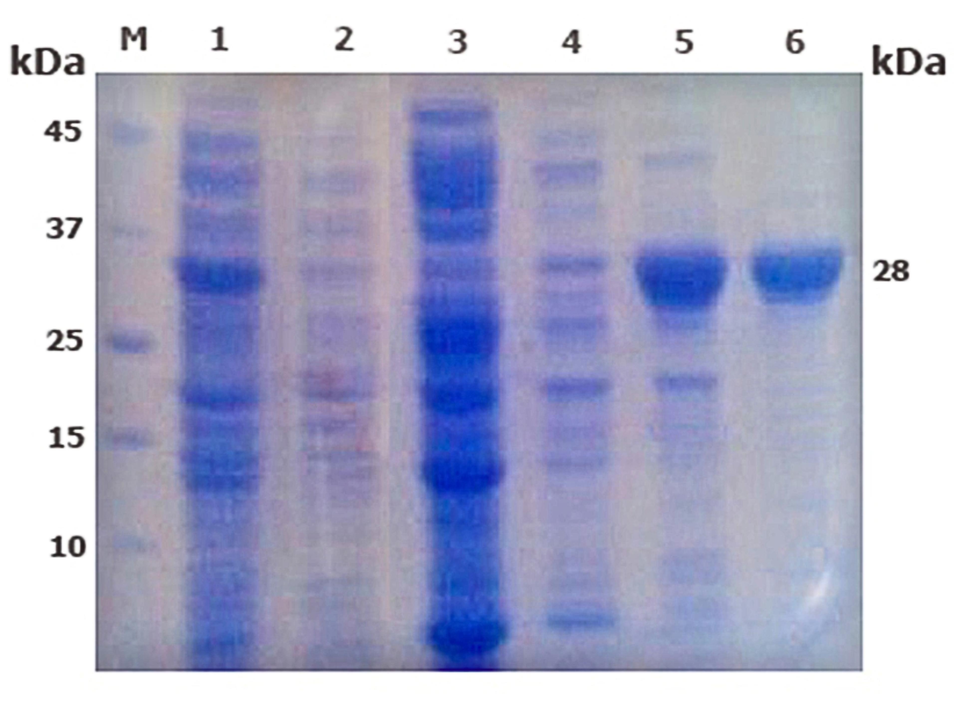 Cloning, expression, and purification of fusion antigens MPT83 and ESAT6 from the local strain of <span>Mycobacterium tuberculosis</span> in <span>Escherichia coli</span> as a seed vaccine candidate against tuberculosis