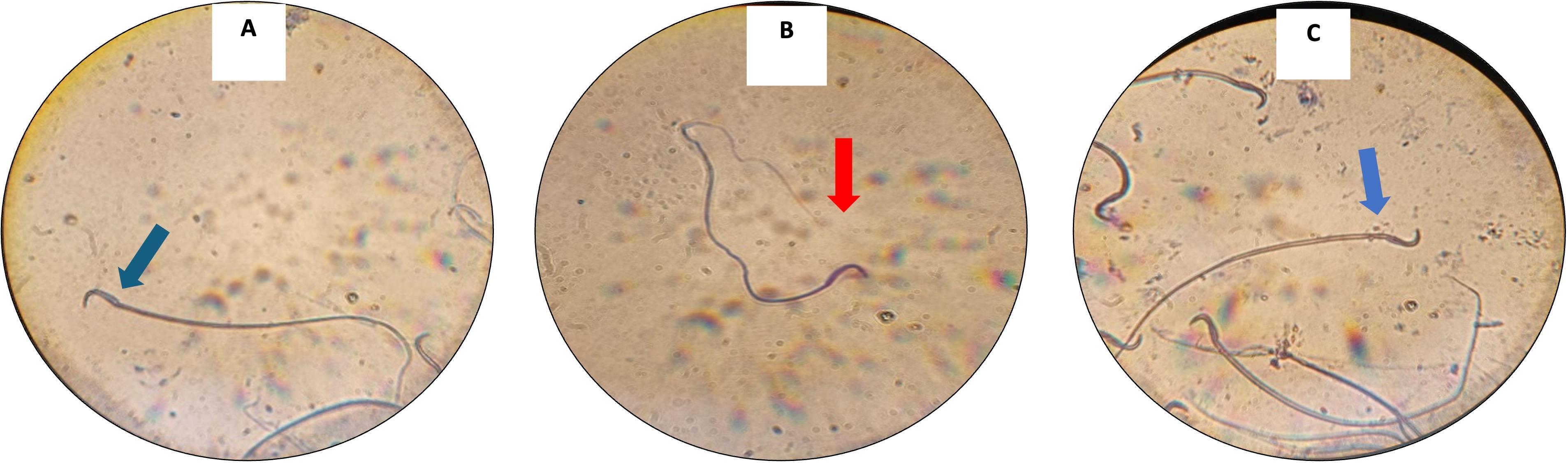 Impact of scutellarin on cyclophosphamide-induced testicular damage in Sprague Dawley male rats