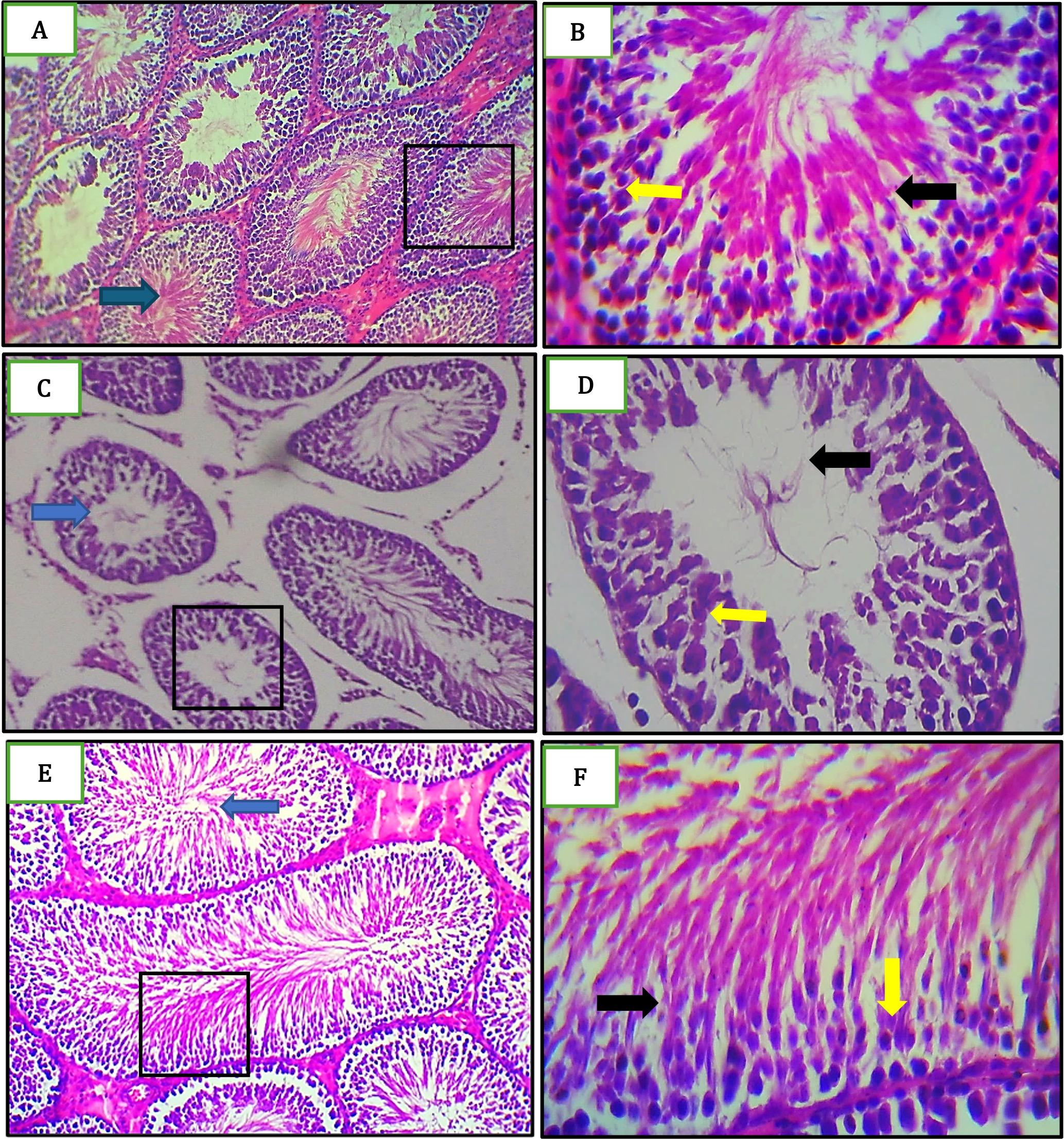 Impact of scutellarin on cyclophosphamide-induced testicular damage in Sprague Dawley male rats