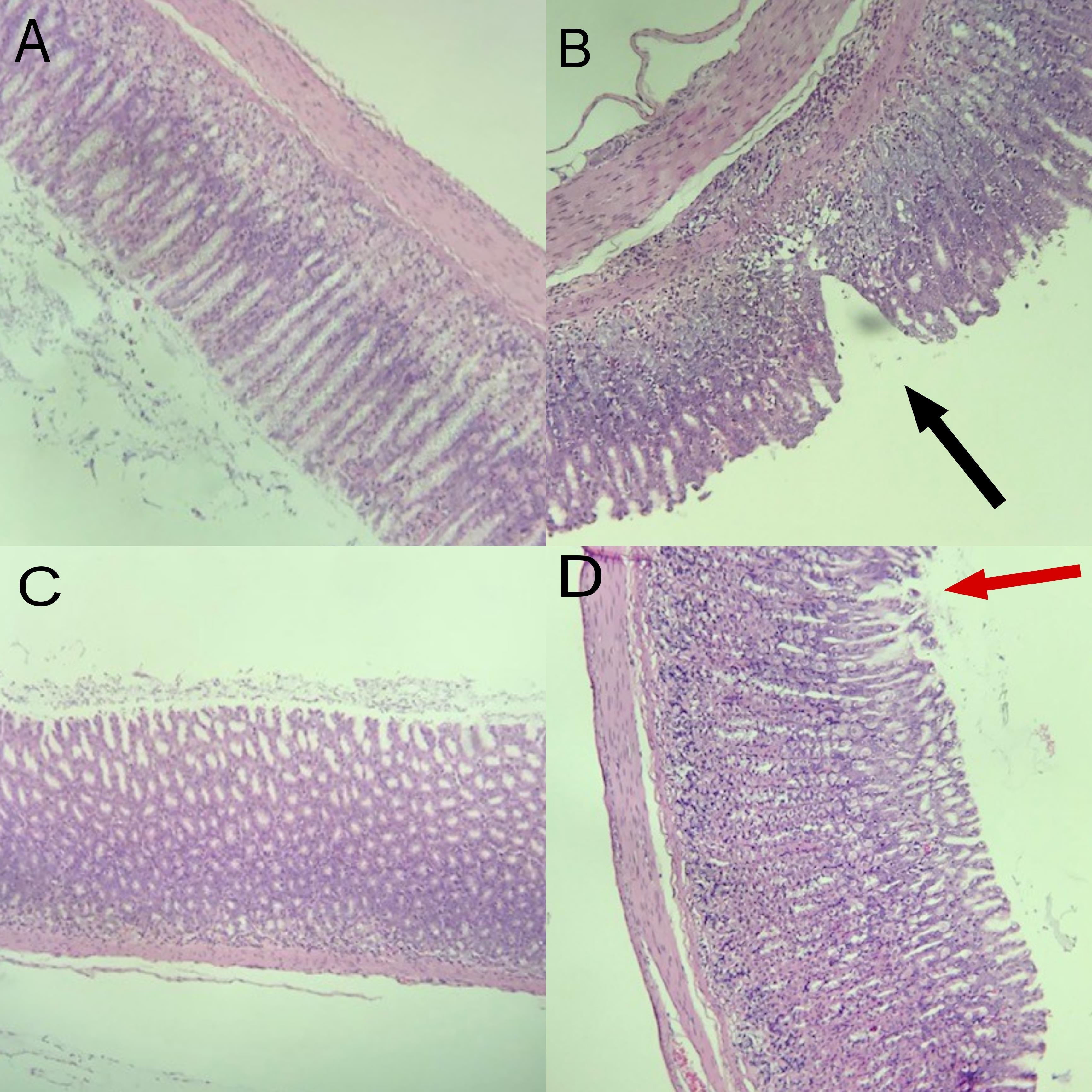 Noni (<span>Morinda citrifolia</span> L.) fruit juice reduces paw edema and protects gastric mucosal injury in rats