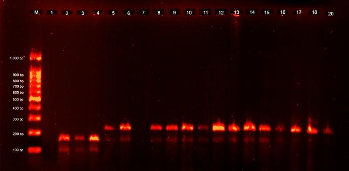 Polymorphisms in the leptin gene and their role in adolescent obesity and metabolic health