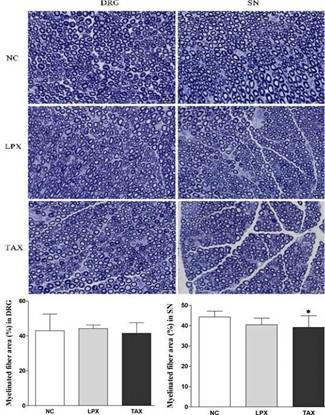 DHP107, a novel oral paclitaxel formulation induces less peripheral neuropathic pain and pain-related molecular alteration than intravenous paclitaxel preparation in rat