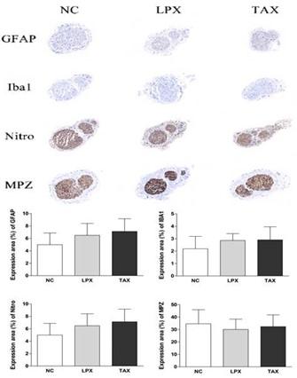 DHP107, a novel oral paclitaxel formulation induces less peripheral neuropathic pain and pain-related molecular alteration than intravenous paclitaxel preparation in rat