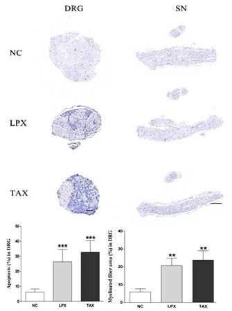 DHP107, a novel oral paclitaxel formulation induces less peripheral neuropathic pain and pain-related molecular alteration than intravenous paclitaxel preparation in rat