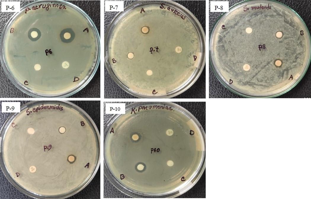 Antibacterial activity of silver nanoparticles synthesized from leaf and flower extracts of Galinsoga formosa