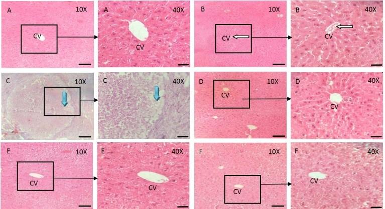 Prophylactic effect of vitamin E and coriander (Coriandrum sativum) seed extract against lead toxicity in liver of Swiss albino mice