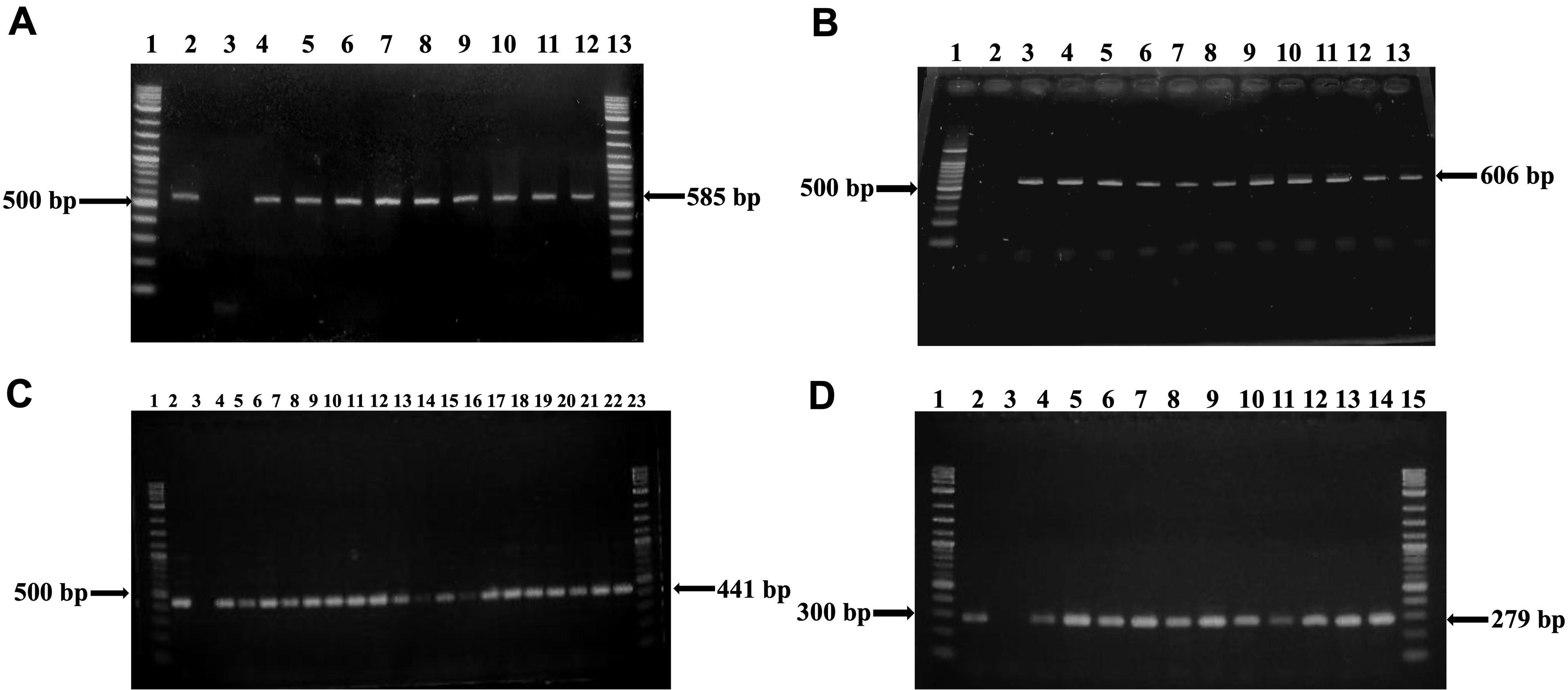 Diversity and resistance profile of bacteria associated with washroom surfaces in Bangladesh Agricultural University residence halls