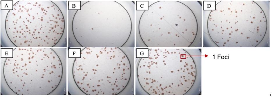 Antiviral and anti-inflammatory activities of favipiravir and quinine sulfate against dengue virus serotype 1 in vitro