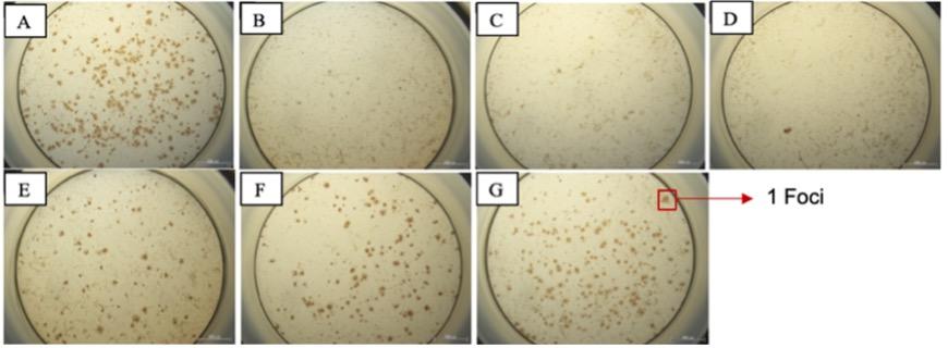 Antiviral and anti-inflammatory activities of favipiravir and quinine sulfate against dengue virus serotype 1 in vitro