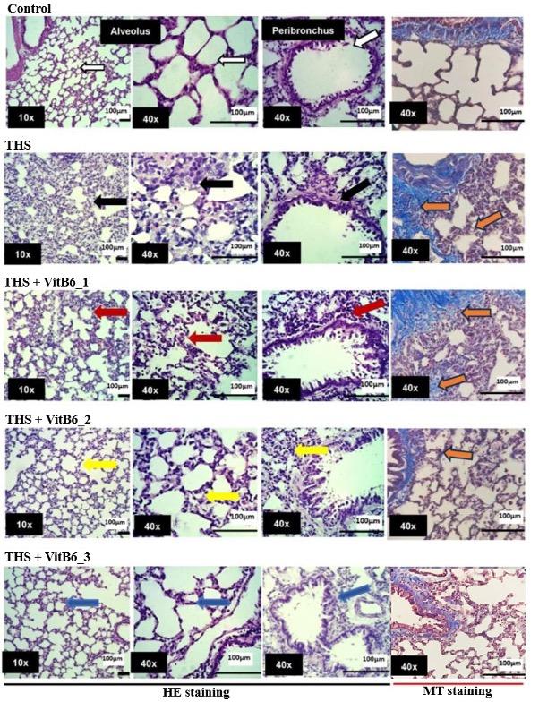 Effect of pyridoxine in attenuating pulmonary pyroptosis-induced by third-hand smoke exposure: An in silico and in vivo study in male Wistar rats