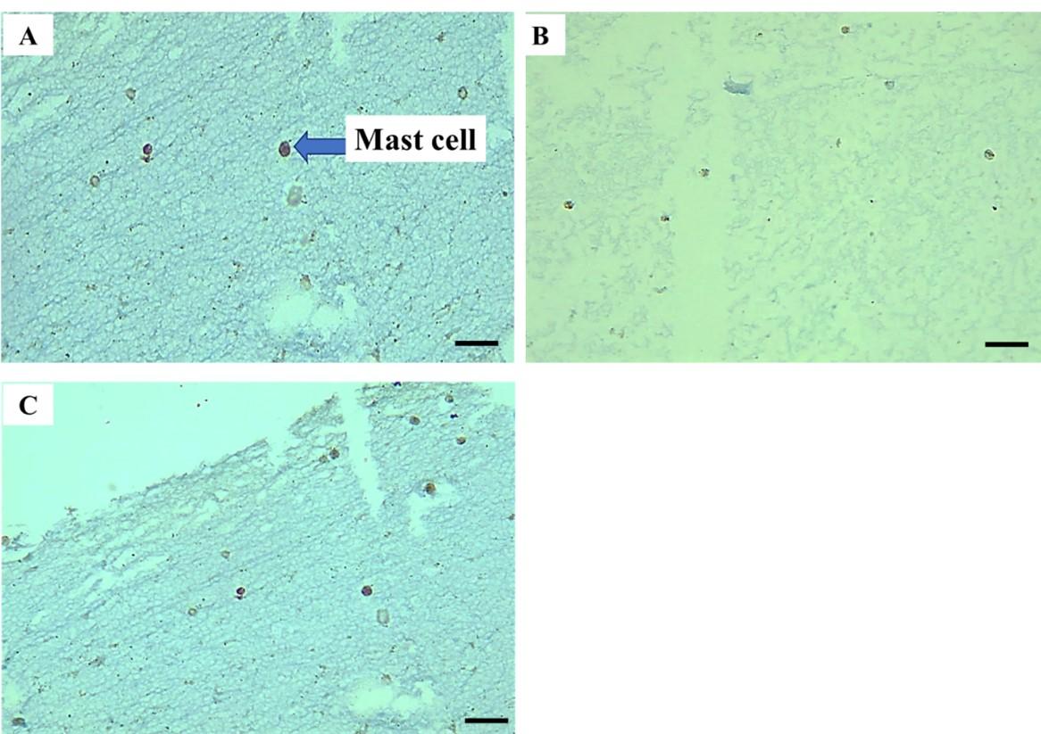 Role of CD117 and mast cells in periodontal diseases: Histological and immunohistochemical study