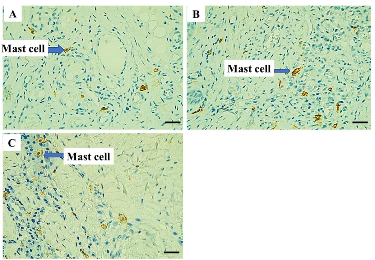 Role of CD117 and mast cells in periodontal diseases: Histological and immunohistochemical study