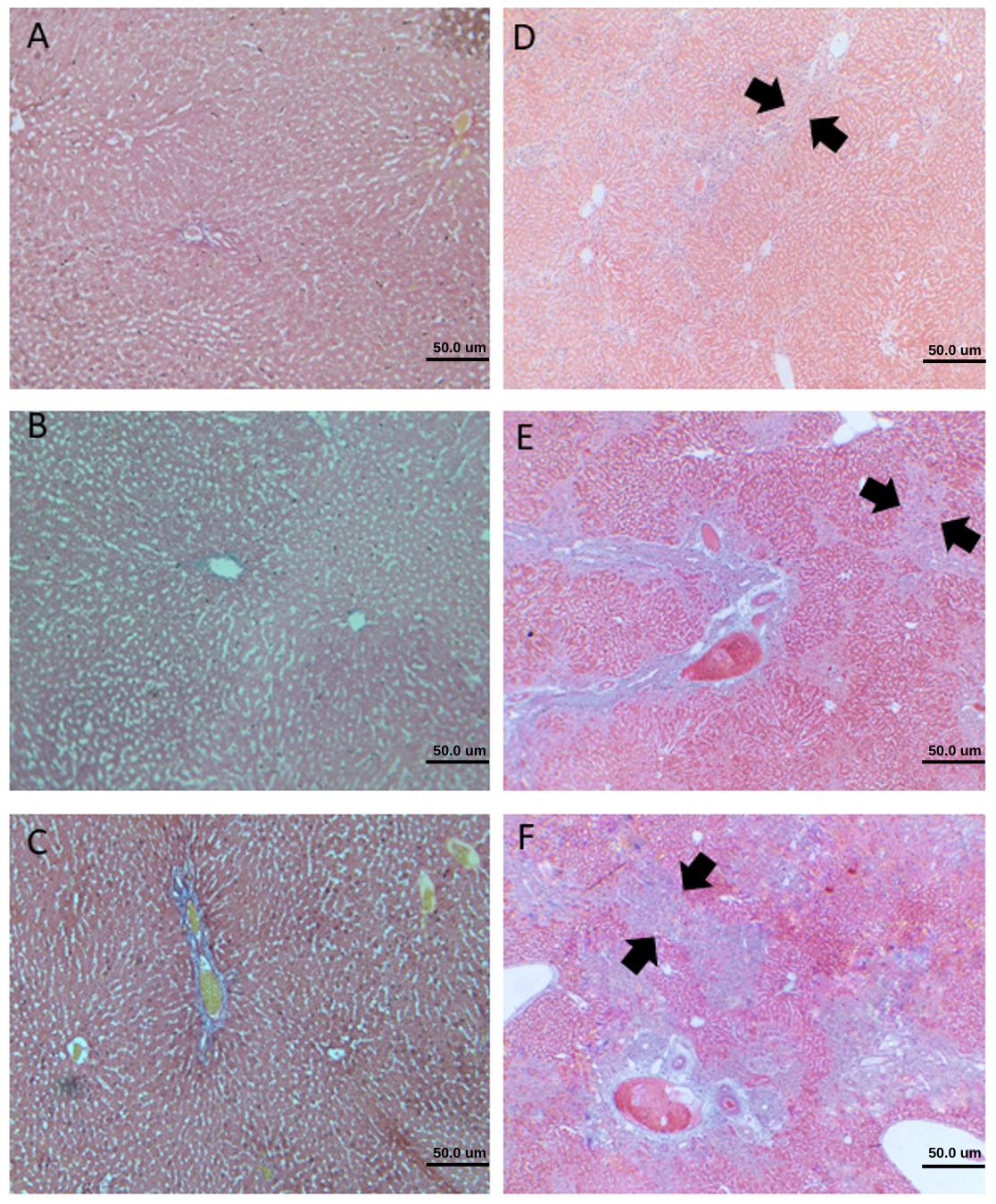 A combination of ursodeoxycholic acid and Allium sativum prevents liver cirrhosis in cholestatic rats