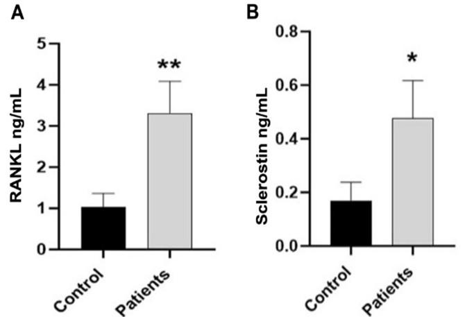Effect of fungal microbiota on RANKL and sclerostin in patients with Crohn's disease