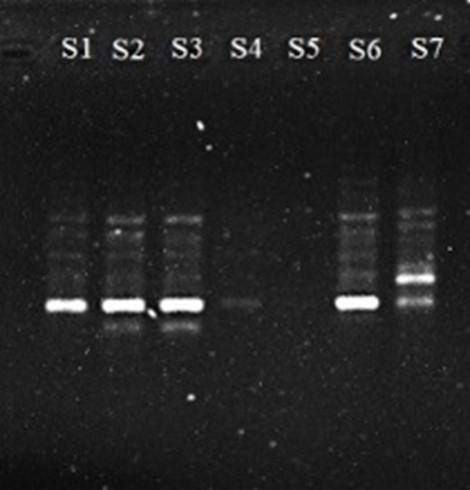 RAPD-markers assisted genetic diversity analysis and <span>Bt-Cry1Ac</span> gene identification in eggplant (<span>Solanum melongena</span> L.)