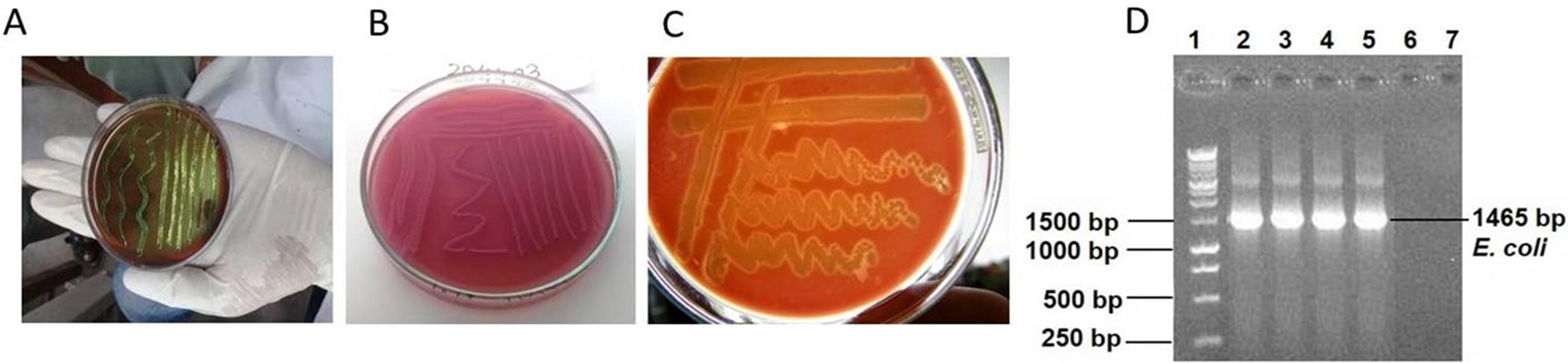 Molecular characterization of multidrug-resistant Escherichia coli isolated from human urine infections with their antibiogram profile