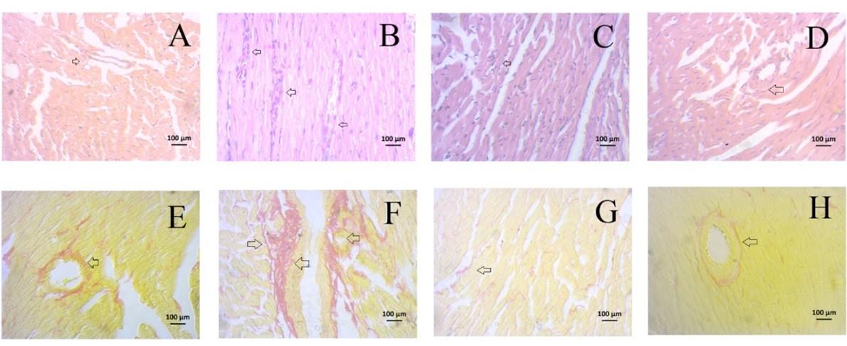 Pomegranate fruit peel extract improves cardiac functions via suppressing oxidative stress, fibrosis, and myocardial infarction in Long-Evans rats