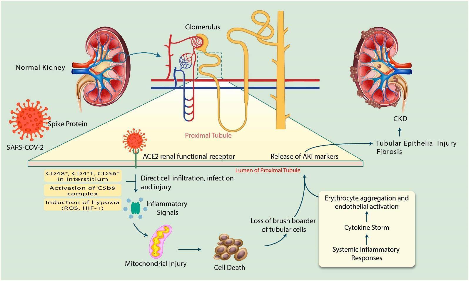Current knowledge on mechanisms involved in SARS-CoV-2 infection and kidney diseases